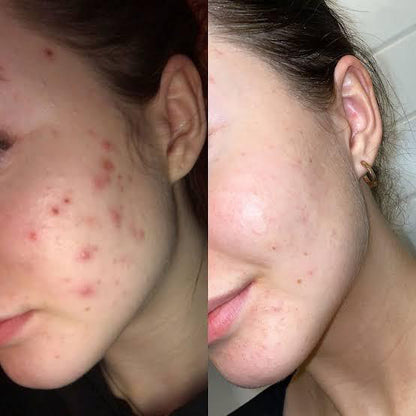 Retinol Mushroom Serum